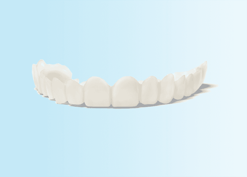 Snap On Smile